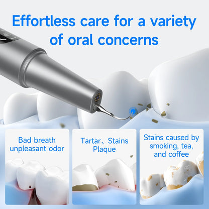 HiSmile Tooth Cleaner
